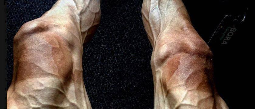 Com foto assustadora das pernas, ciclista revela a dor do esporte