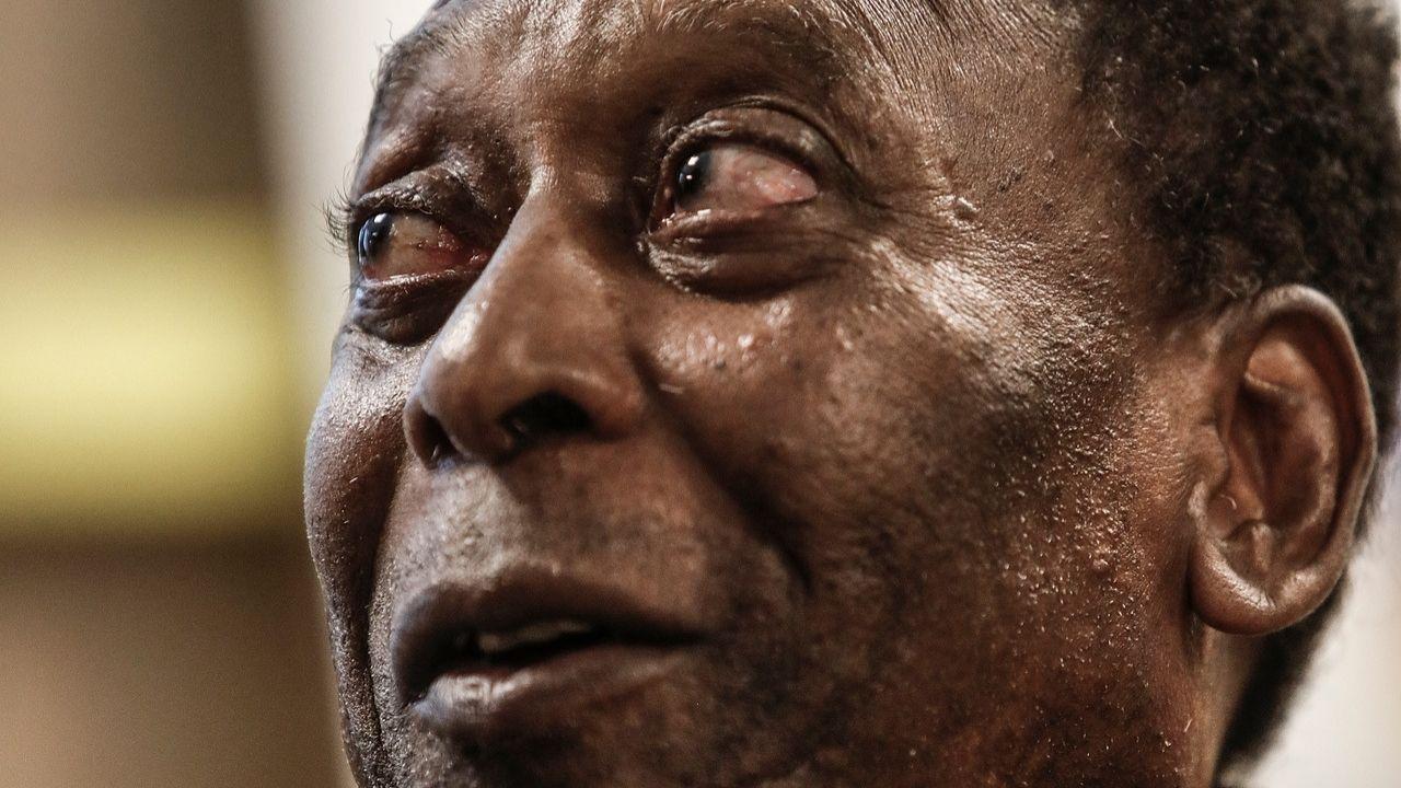 Internado em São Paulo, Pelé passa por cirurgia para retirada de tumor no cólon