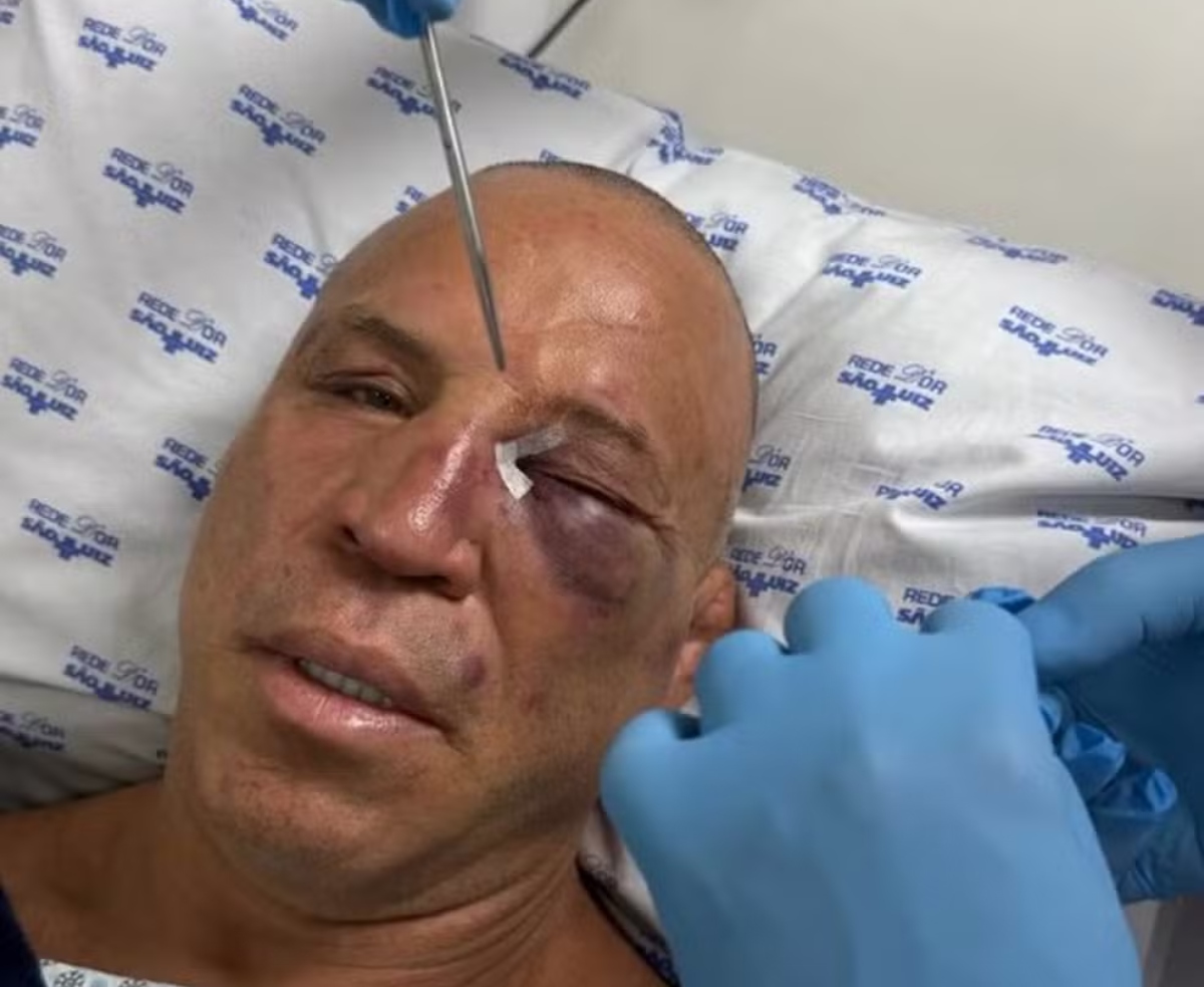 Ex-campeão do UFC dispara contra Popó e sua equipe após briga generalizada