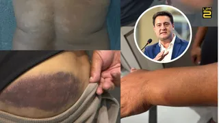 Campeão mundial é agredido pela Polícia Militar no Paraná e Ratinho Jr. reage