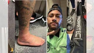 Neymar mostra pé inchado em meio à recuperação de lesão no tornozelo