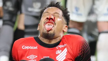 Athletico abre protocolo de concussão para zagueiro que sofreu choque no rosto