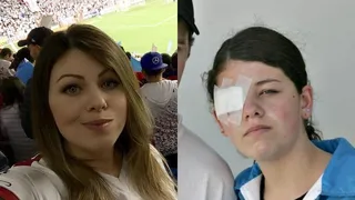 Ela perdeu a visão em um dia de violência no clássico. Mas o amor pelo Paraná a ajuda a vencer o trauma