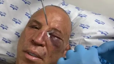 Ex-campeão do UFC dispara contra Popó e sua equipe após briga generalizada