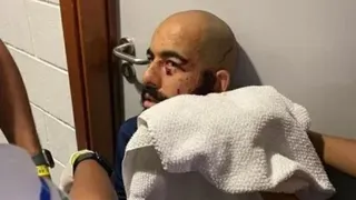 Bahia protesta após polícia indiciar ataque ao ônibus como lesão corporal leve