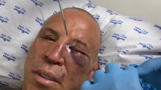 Ex-campeão do UFC dispara contra Popó e sua equipe após briga generalizada