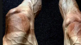 Com foto assustadora das pernas, ciclista revela a dor do esporte