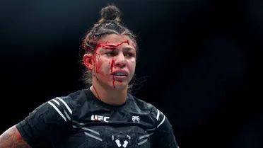 UFC: Sheetara mostra como ficou seu corte no supercílio