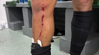 Athletico reclama da arbitragem nas redes: “Nem falta?”
